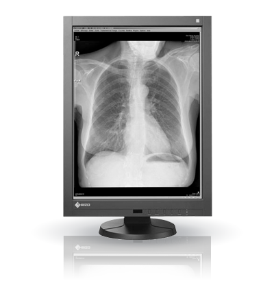 Buy EIZO RadiForce GX340 3MP Grayscale Diagnostic Monitor
