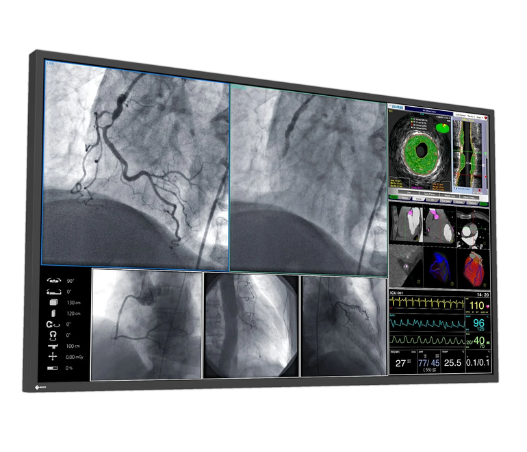 Buy EIZO CuratOR LL550W 55 Inch Interventional Cath Lab Display