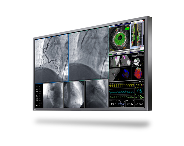 Buy EIZO CuratOR LX560W Surgical Monitor System