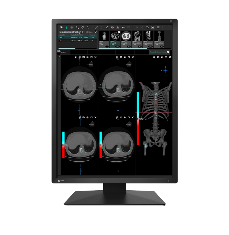 EIZO RadiForce MX217 clinical display