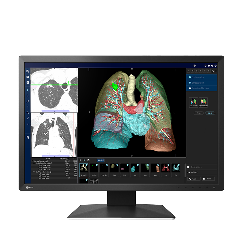 EIZO RadiForce MX243W clinical display