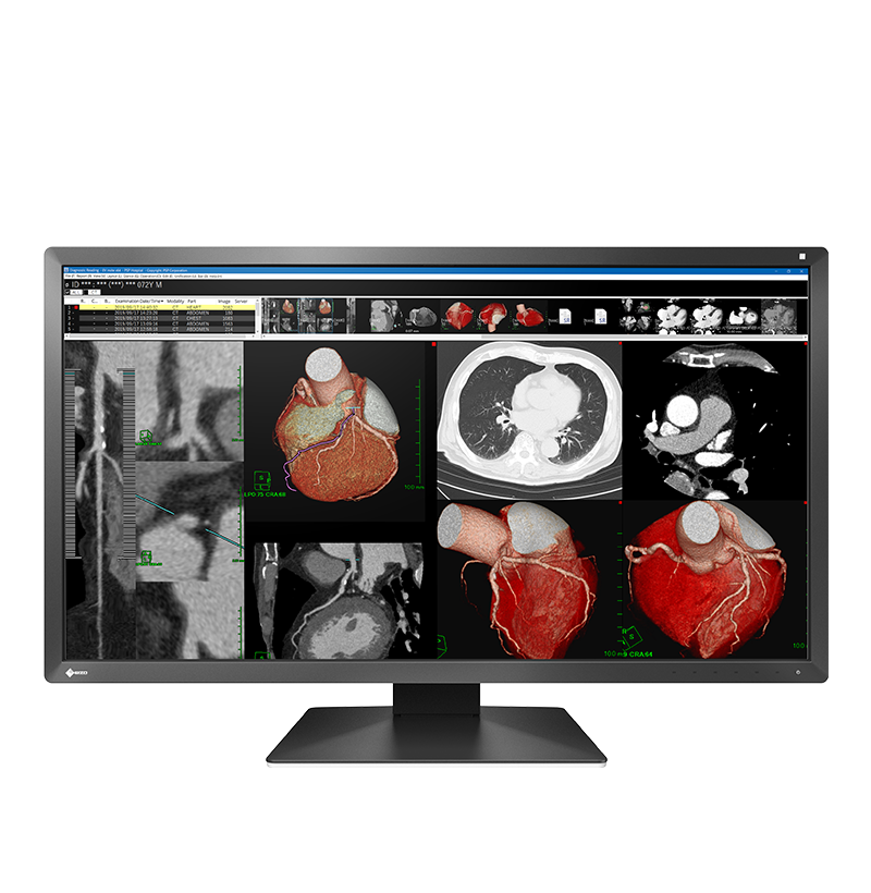 EIZO RadiForce MX317W and PX3150 display family