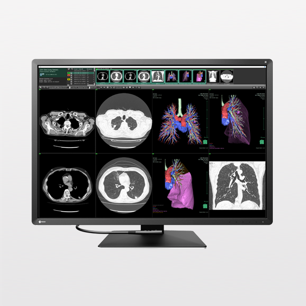 EIZO RadiForce RX1270 diagnostic monitor