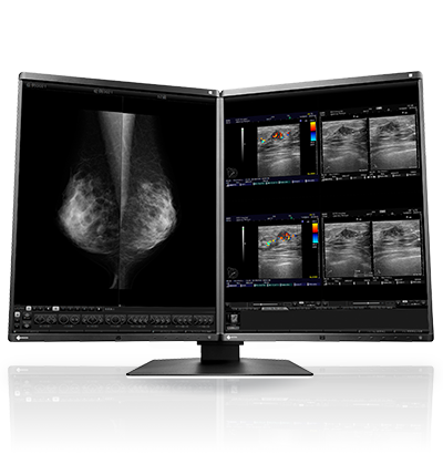 EIZO RadiForce RX560 diagnostic monitor
