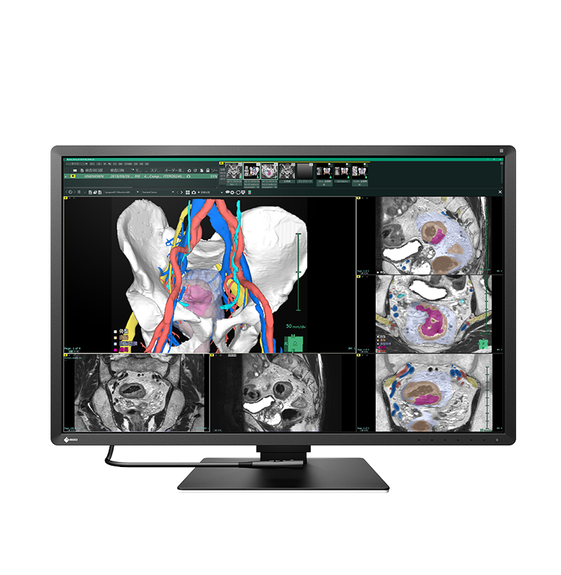 EIZO RadiForce RX670 diagnostic monitor